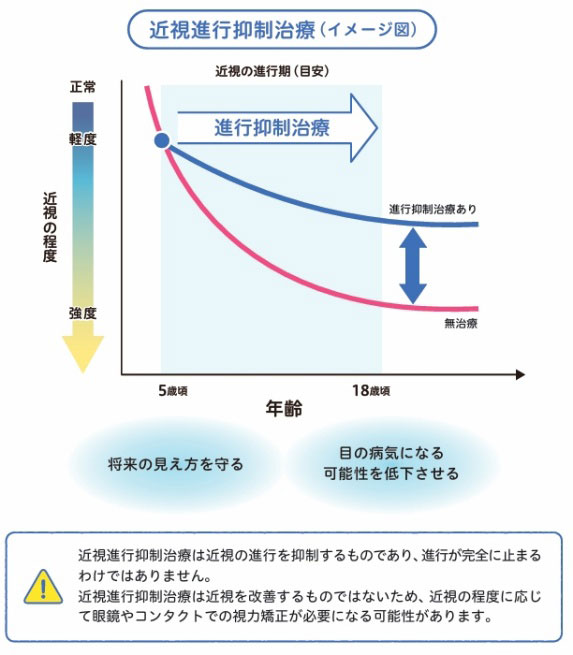 禁止進行抑制治療イメージ