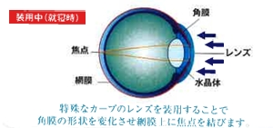 オルソケラトロジーの仕組み3